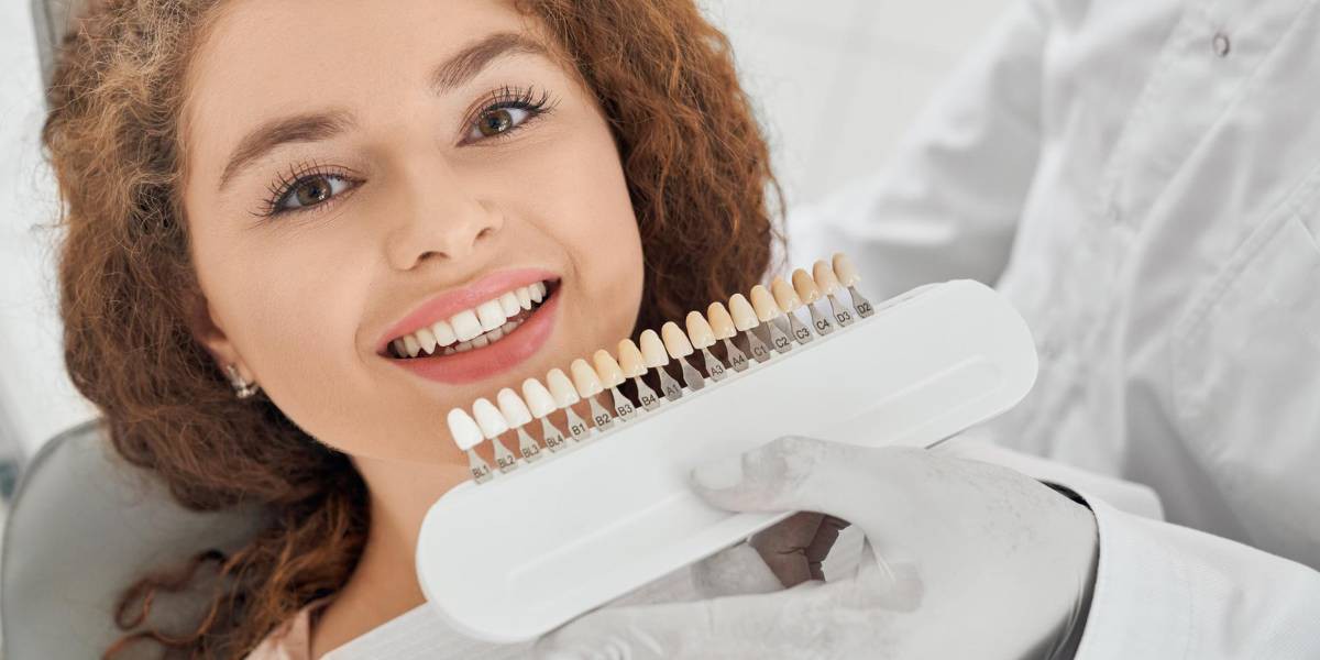 Clareamento Dental: O Que Você Precisa Saber Antes de Fazer